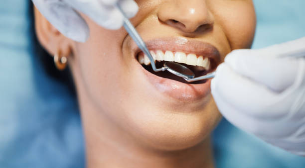 Best Dental Abscess Treatment in Greenville, FL