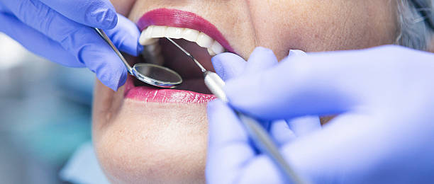 Professional Emergency Dental Service in FL